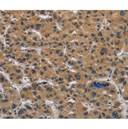 Immunohistochemistry - CLDN2 Antibody from Signalway Antibody (36890) - Antibodies.com