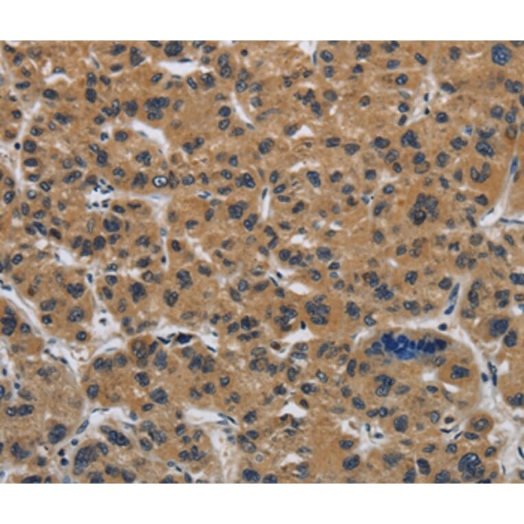Immunohistochemistry - CLDN2 Antibody from Signalway Antibody (36890) - Antibodies.com