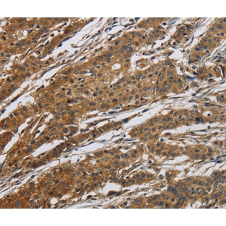 Immunohistochemistry - CLDN2 Antibody from Signalway Antibody (36890) - Antibodies.com