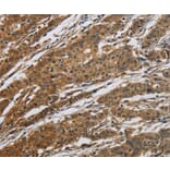Immunohistochemistry - CLDN2 Antibody from Signalway Antibody (36890) - Antibodies.com