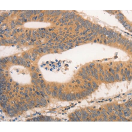 Immunohistochemistry - CSF3R Antibody from Signalway Antibody (36896) - Antibodies.com