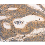 Immunohistochemistry - CSF3R Antibody from Signalway Antibody (36896) - Antibodies.com