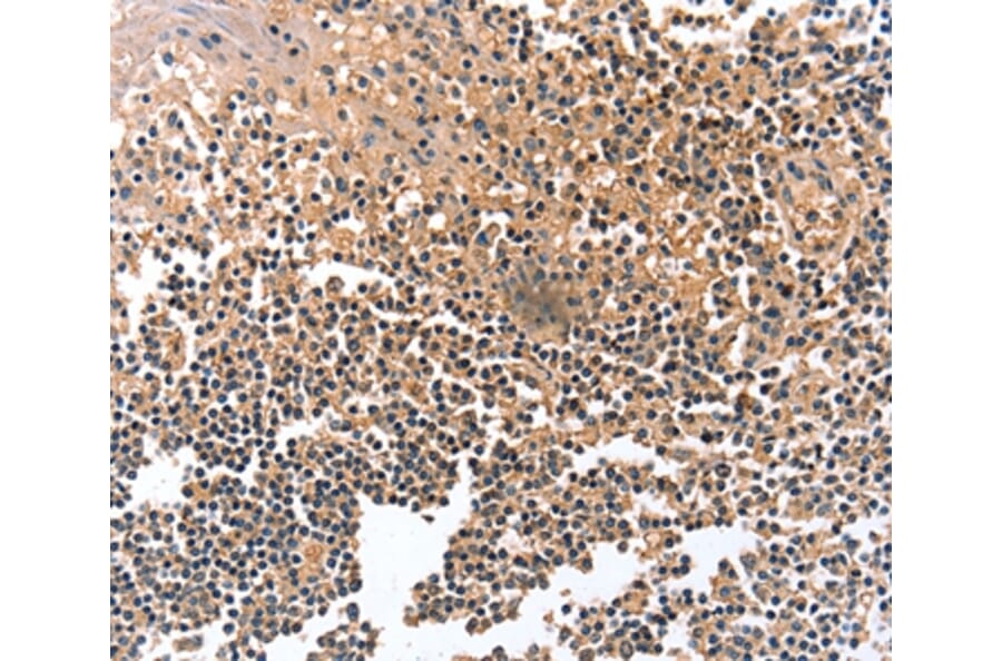 Immunohistochemistry - GRB10 Antibody from Signalway Antibody (36908) - Antibodies.com