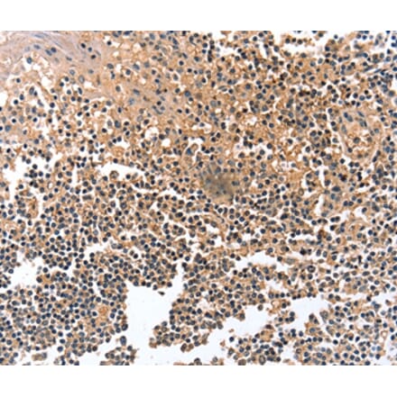 Immunohistochemistry - GRB10 Antibody from Signalway Antibody (36908) - Antibodies.com