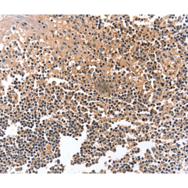 Immunohistochemistry - GRB10 Antibody from Signalway Antibody (36908) - Antibodies.com