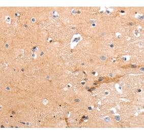 Immunohistochemistry - GPR64 Antibody from Signalway Antibody (36911) - Antibodies.com
