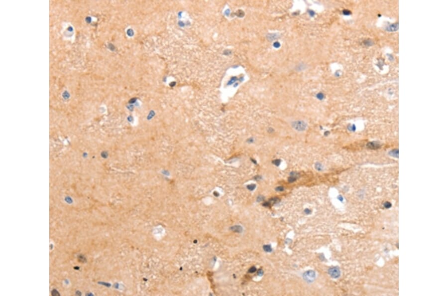 Immunohistochemistry - GPR64 Antibody from Signalway Antibody (36911) - Antibodies.com