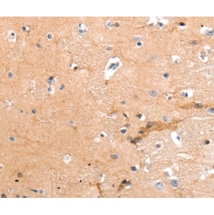Immunohistochemistry - GPR64 Antibody from Signalway Antibody (36911) - Antibodies.com