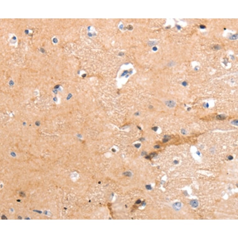 Immunohistochemistry - GPR64 Antibody from Signalway Antibody (36911) - Antibodies.com