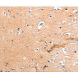 Immunohistochemistry - GPR64 Antibody from Signalway Antibody (36911) - Antibodies.com