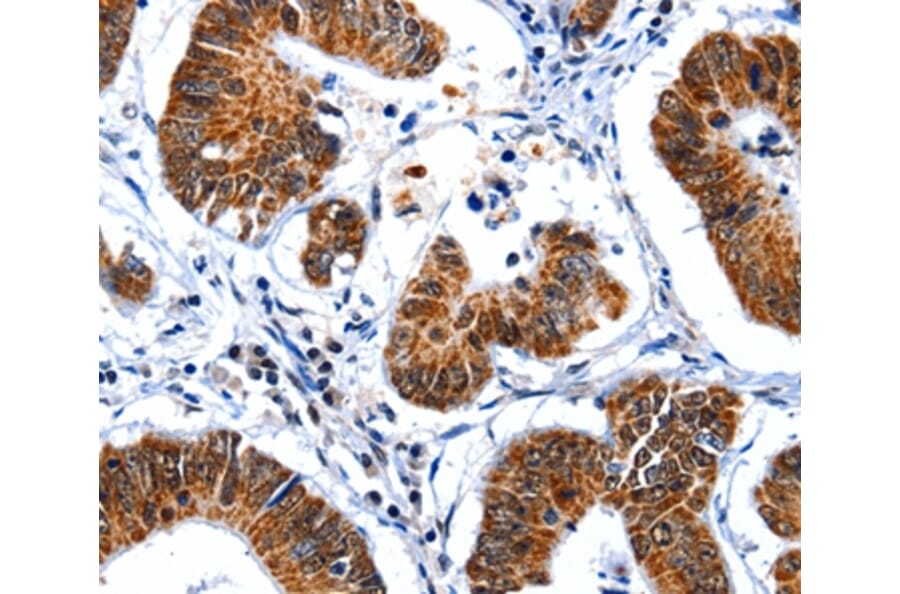 Immunohistochemistry - GSK3A Antibody from Signalway Antibody (36917) - Antibodies.com