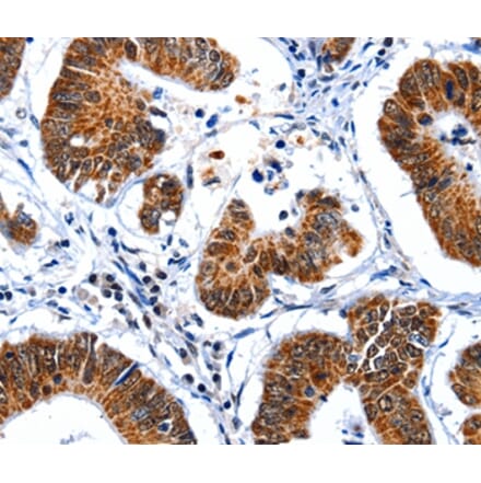 Immunohistochemistry - GSK3A Antibody from Signalway Antibody (36917) - Antibodies.com