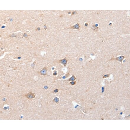 Immunohistochemistry - KCNH8 Antibody from Signalway Antibody (36921) - Antibodies.com