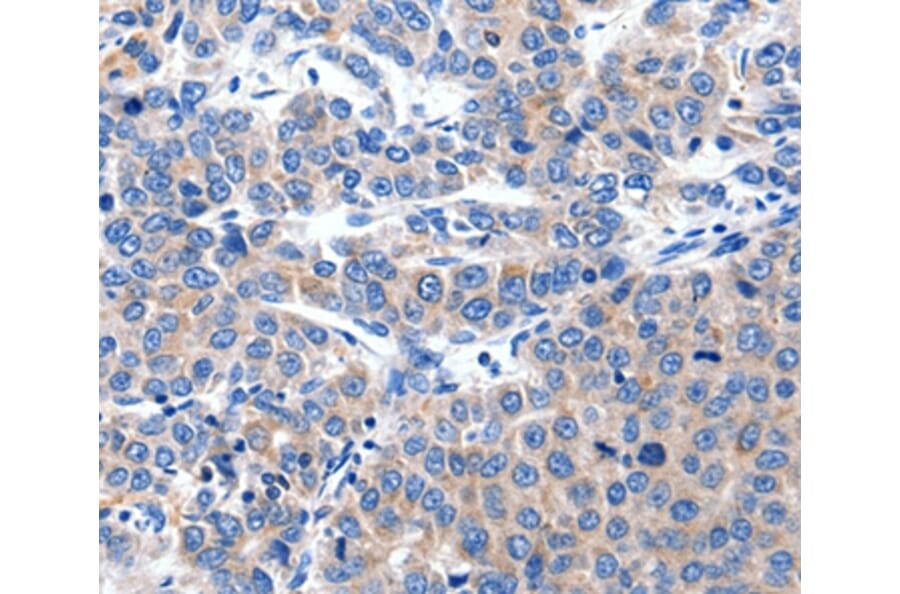 Immunohistochemistry - KCNH8 Antibody from Signalway Antibody (36921) - Antibodies.com