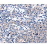 Immunohistochemistry - KCNH8 Antibody from Signalway Antibody (36921) - Antibodies.com