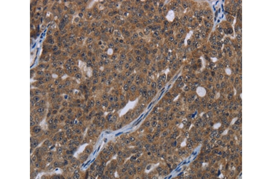 Immunohistochemistry - HOXC8 Antibody from Signalway Antibody (36923) - Antibodies.com