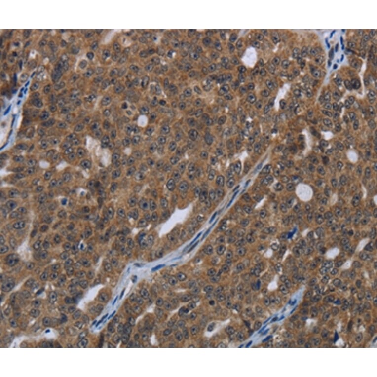 Immunohistochemistry - HOXC8 Antibody from Signalway Antibody (36923) - Antibodies.com