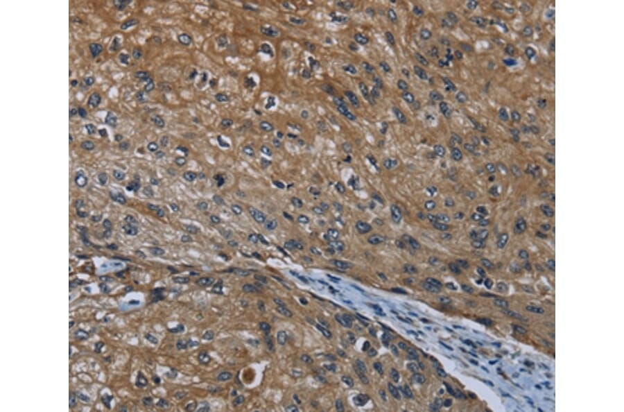 Immunohistochemistry - HOXC8 Antibody from Signalway Antibody (36923) - Antibodies.com