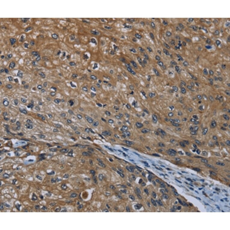 Immunohistochemistry - HOXC8 Antibody from Signalway Antibody (36923) - Antibodies.com