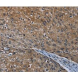 Immunohistochemistry - HOXC8 Antibody from Signalway Antibody (36923) - Antibodies.com