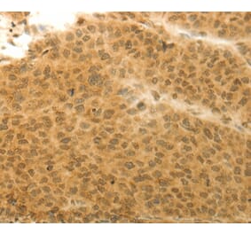 Immunohistochemistry - HOXA4 Antibody from Signalway Antibody (36924) - Antibodies.com