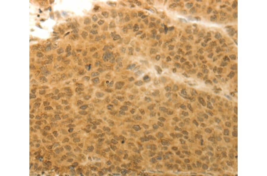 Immunohistochemistry - HOXA4 Antibody from Signalway Antibody (36924) - Antibodies.com