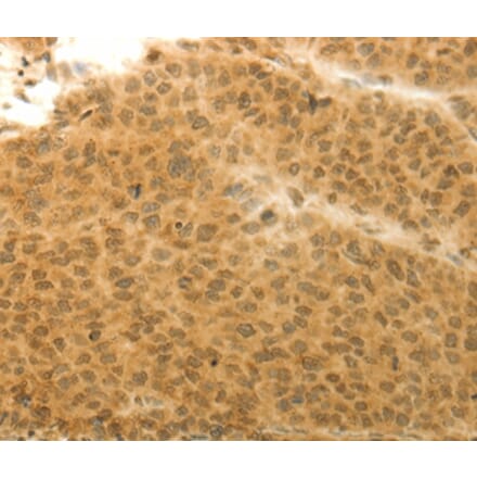 Immunohistochemistry - HOXA4 Antibody from Signalway Antibody (36924) - Antibodies.com