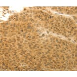 Immunohistochemistry - HOXA4 Antibody from Signalway Antibody (36924) - Antibodies.com