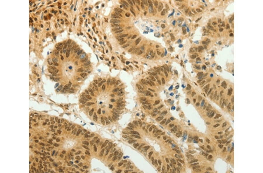 Immunohistochemistry - HOXA4 Antibody from Signalway Antibody (36924) - Antibodies.com
