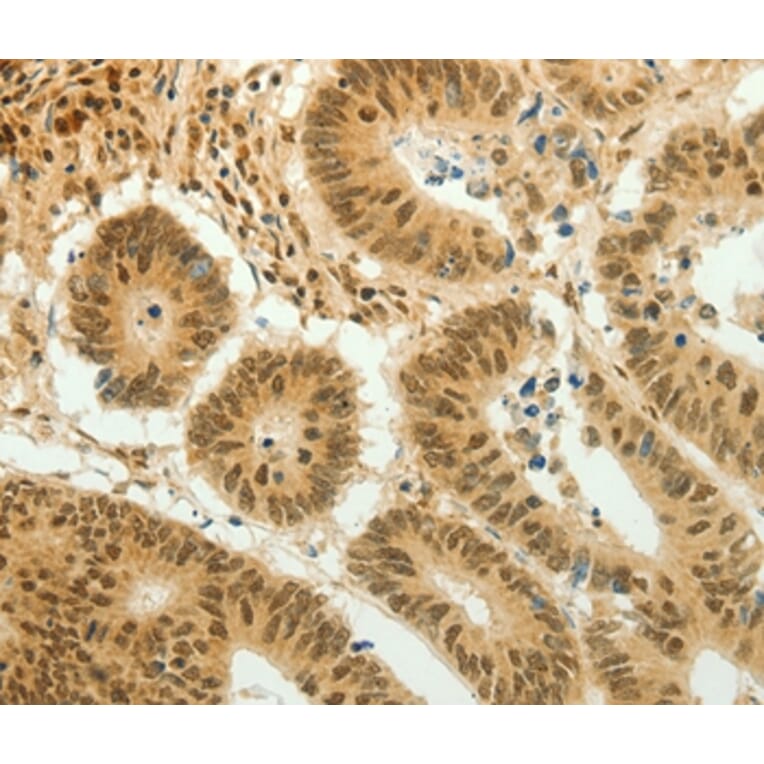 Immunohistochemistry - HOXA4 Antibody from Signalway Antibody (36924) - Antibodies.com
