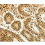 Immunohistochemistry - HOXA4 Antibody from Signalway Antibody (36924) - Antibodies.com