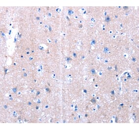 Immunohistochemistry - LAMA3 Antibody from Signalway Antibody (36945) - Antibodies.com