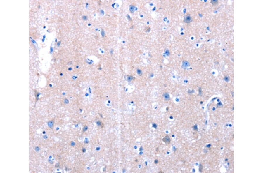 Immunohistochemistry - LAMA3 Antibody from Signalway Antibody (36945) - Antibodies.com