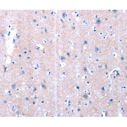 Immunohistochemistry - LAMA3 Antibody from Signalway Antibody (36945) - Antibodies.com