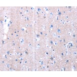 Immunohistochemistry - LAMA3 Antibody from Signalway Antibody (36945) - Antibodies.com