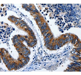 Immunohistochemistry - LAMA1 Antibody from Signalway Antibody (36953) - Antibodies.com