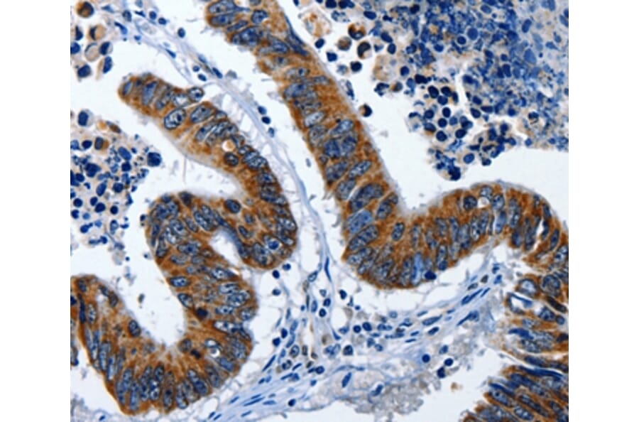 Immunohistochemistry - LAMA1 Antibody from Signalway Antibody (36953) - Antibodies.com