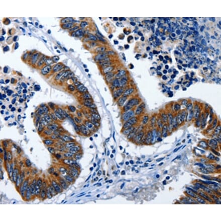 Immunohistochemistry - LAMA1 Antibody from Signalway Antibody (36953) - Antibodies.com