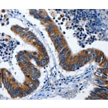 Immunohistochemistry - LAMA1 Antibody from Signalway Antibody (36953) - Antibodies.com