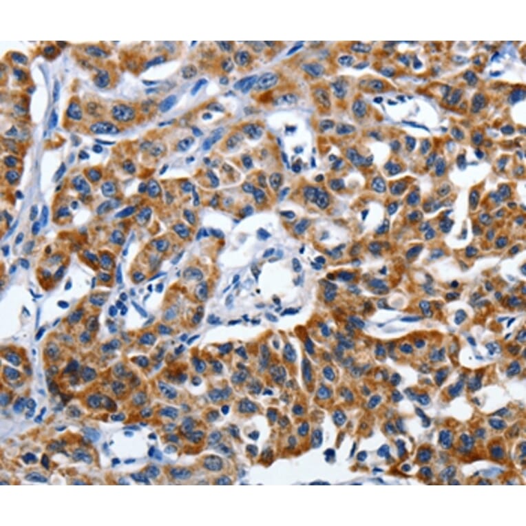 Immunohistochemistry - LAMA1 Antibody from Signalway Antibody (36953) - Antibodies.com