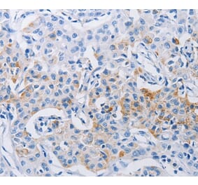 Immunohistochemistry - LRIG1 Antibody from Signalway Antibody (36954) - Antibodies.com