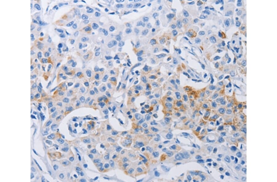 Immunohistochemistry - LRIG1 Antibody from Signalway Antibody (36954) - Antibodies.com