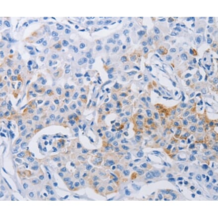 Immunohistochemistry - LRIG1 Antibody from Signalway Antibody (36954) - Antibodies.com