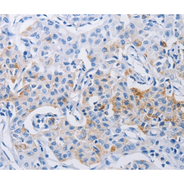 Immunohistochemistry - LRIG1 Antibody from Signalway Antibody (36954) - Antibodies.com