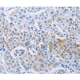 Immunohistochemistry - LRIG1 Antibody from Signalway Antibody (36954) - Antibodies.com