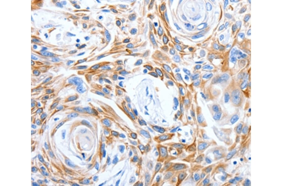 Immunohistochemistry - LRIG3 Antibody from Signalway Antibody (36955) - Antibodies.com