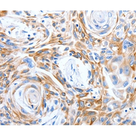 Immunohistochemistry - LRIG3 Antibody from Signalway Antibody (36955) - Antibodies.com