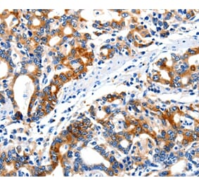 Immunohistochemistry - ITGAX Antibody from Signalway Antibody (36961) - Antibodies.com