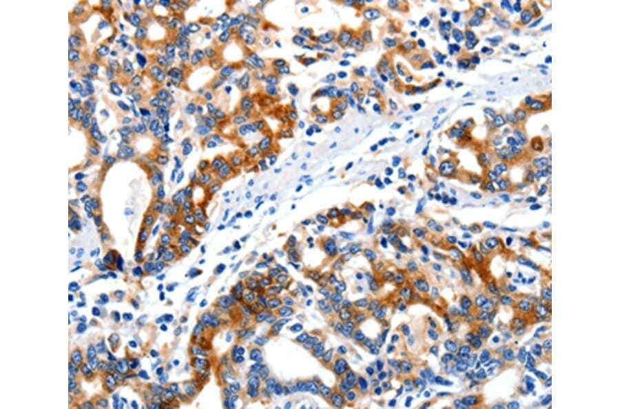 Immunohistochemistry - ITGAX Antibody from Signalway Antibody (36961) - Antibodies.com