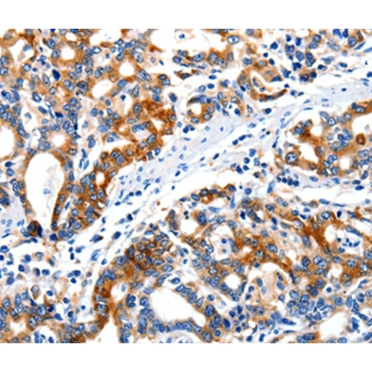 Immunohistochemistry - ITGAX Antibody from Signalway Antibody (36961) - Antibodies.com